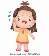 Image result for Pox Baby Shutterstock