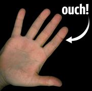 Image result for Ouch Hand