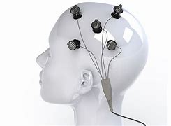 Image result for What Is a tDCS