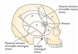 Image result for Middle Meningeal Artery Grove of Skull