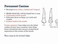 Image result for Maxillary Canine Pulp