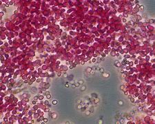 Image result for Yeast for Alcholo