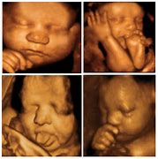 Image result for 5D Scanner Baby