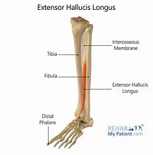 Image result for Extensor Digitorum Tendon