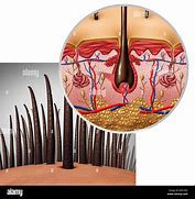 Image result for Hair Follicle Anatomy