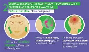 Image result for Signs of an Ocular Migraine