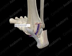 Image result for Flexor Retinaculum Ankle Thicking