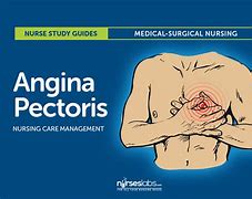 Image result for Vasodilators in Angina Pectoris