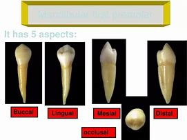 Image result for Mandibular 1st Premolar