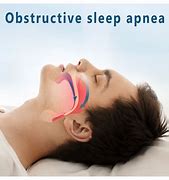 Image result for Osa Sleep Apnea