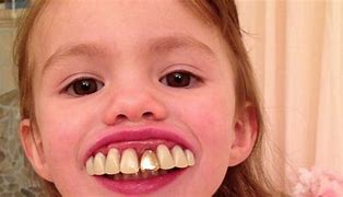 Image result for Big Teeth and Ears