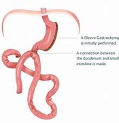 Image result for Sadi Anatomy