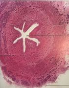 Image result for Ureter Histology Slides Labeled