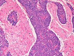 Image result for Brain Tissue Histology