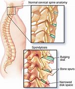 Image result for Pin Nerve Function