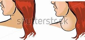 Image result for Swelling Clip Art