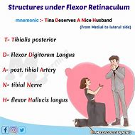 Image result for Structures Under Flexor Retinaculum of Hand