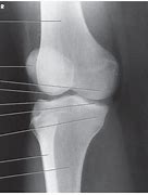 Image result for Knee Lateral Rotation