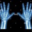 Image result for Child's Hand X-ray