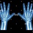 Image result for Thumb X-ray Child