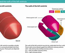 Image result for Acral Ischemia