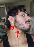 Image result for Getting Patches in My Beard