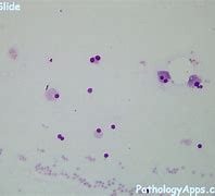 Image result for Adrenal Cytology