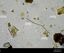 Image result for Fungi without Hyphae