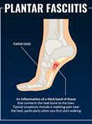 Image result for Plantar Fascia Ligament Pain