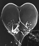 Image result for Protozoan Giardia Lamblia