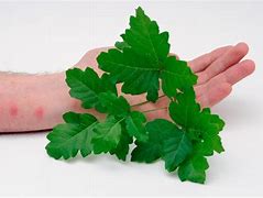 Image result for Poison Ivy Oak Sumac Rash