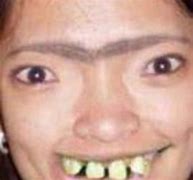 Image result for Big Teeth Girl Memes