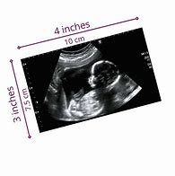 Image result for Baby Sonogram