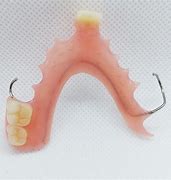 Image result for Upper Partial Dentures Pictures