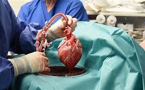 Image result for Pig Heart Transplant