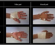 Image result for Volar Aspect Finger