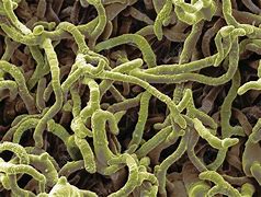 Image result for Fungal Hyphae and Spores