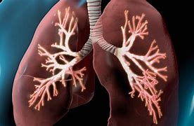 Image result for COPD 3D