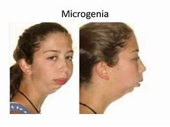 Image result for Microgenia