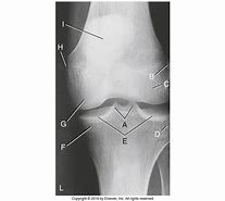 Image result for Knee Labeling