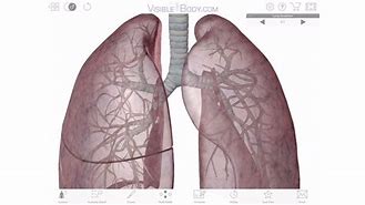 Image result for COPD 3D