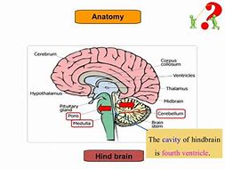 Image result for Medulloblastoma Location Diagram