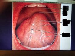 Image result for Side of Tongue Anatomy