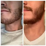 Image result for Getting Patches in My Beard