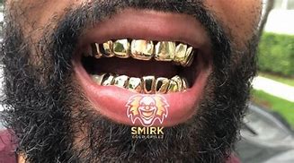 Image result for 10K Gold Grillz