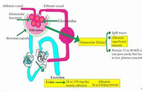 Image result for Urine Albumin