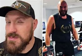 Image result for Tyson Fury Eye Injury