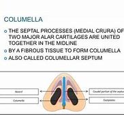 Image result for Columella Septum