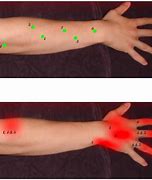 Image result for Pain in Wrist below Thumb