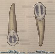 Image result for Maxillary Canine Pulp